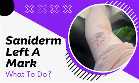 saniderm spray|What to Do if Saniderm Is Stuck to Your Tattoo